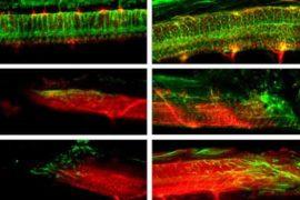 2026/06/microrobots-repair-spinal-cord-injury.jpg