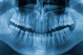 2026/06/body-hidden-ability-grow-teeth-again.jpg